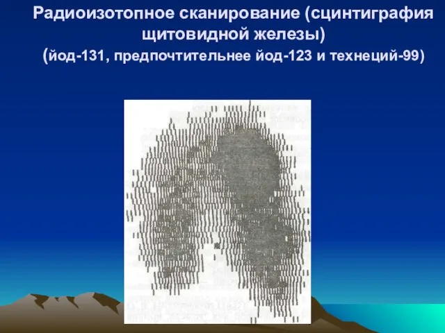 Радиоизотопное сканирование (сцинтиграфия щитовидной железы) (йод-131, предпочтительнее йод-123 и технеций-99)