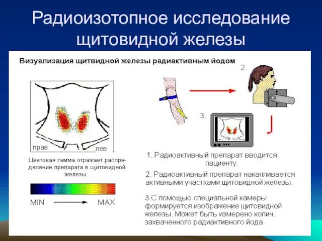 Радиоизотопное исследование щитовидной железы