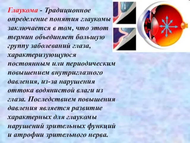 Глаукома - Традиционное определение понятия глаукомы заключается в том, что этот