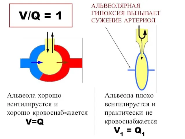 V/Q = 1 Альвеола хорошо вентилируется и хорошо кровоснаб-жается V=Q Альвеола