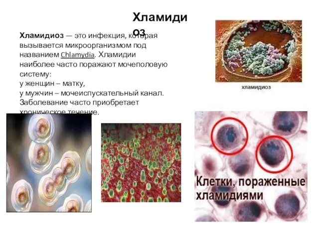 Хламидиоз — это инфекция, которая вызывается микроорганизмом под названием Chlamydia. Хламидии