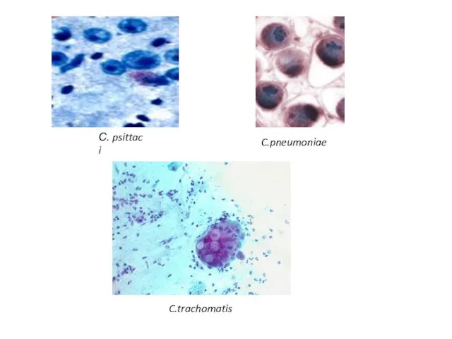 C.trachomatis C.pneumoniae С. psittaci