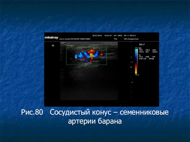 Рис.80 Сосудистый конус – семенниковые артерии барана