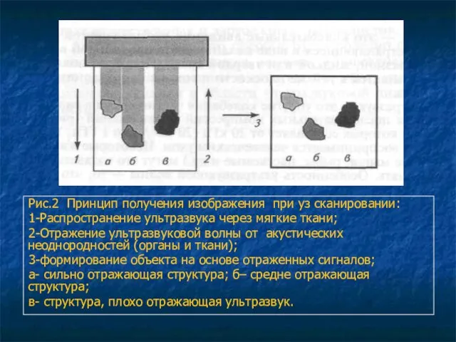 Рис.2 Принцип получения изображения при уз сканировании: 1-Распространение ультразвука через мягкие