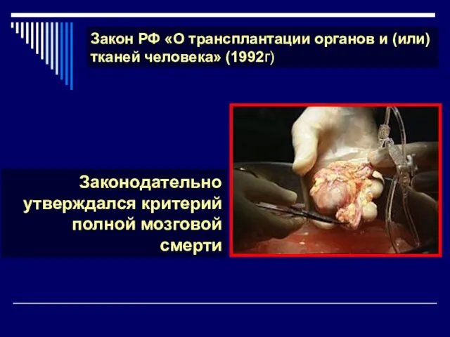 Закон РФ «О трансплантации органов и (или) тканей человека» (1992г) Законодательно утверждался критерий полной мозговой смерти