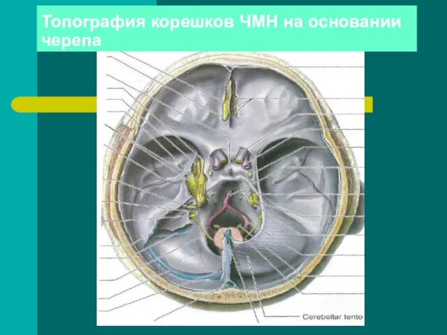 Топография корешков ЧМН на основании черепа