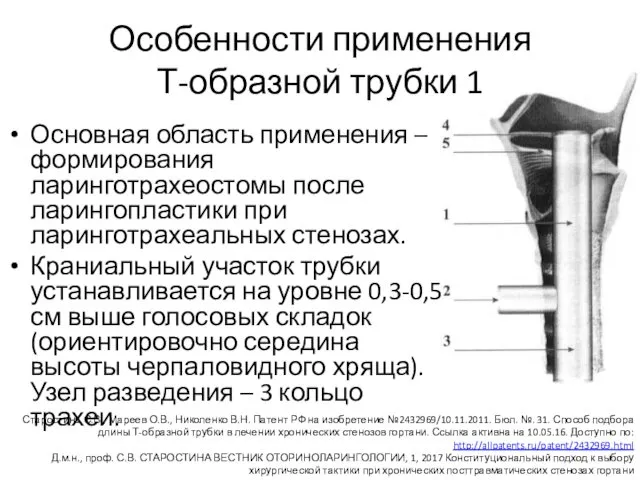 Особенности применения Т-образной трубки 1 Основная область применения – формирования ларинготрахеостомы