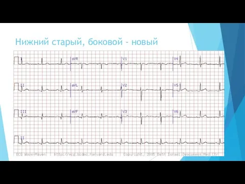 Нижний старый, боковой - новый