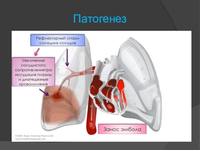 Патогенез