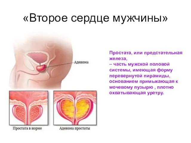 «Второе сердце мужчины» Простата, или предстательная железа, – часть мужской половой