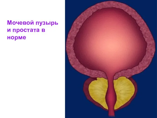 Мочевой пузырь и простата в норме