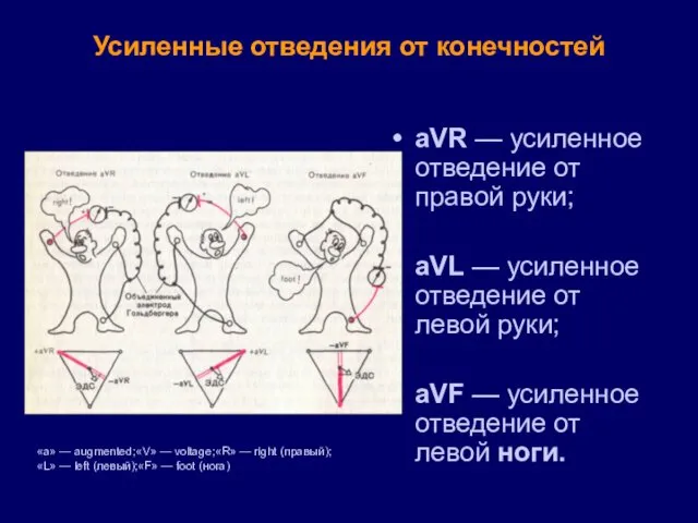 Усиленные отведения от конечностей aVR — усиленное отведение от правой руки;