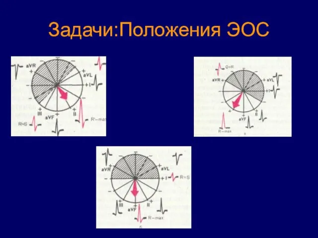 Задачи:Положения ЭОС