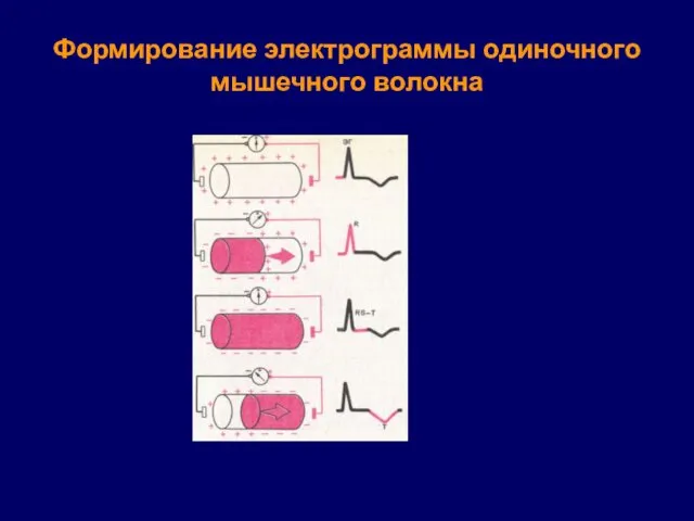 Формирование электрограммы одиночного мышечного волокна