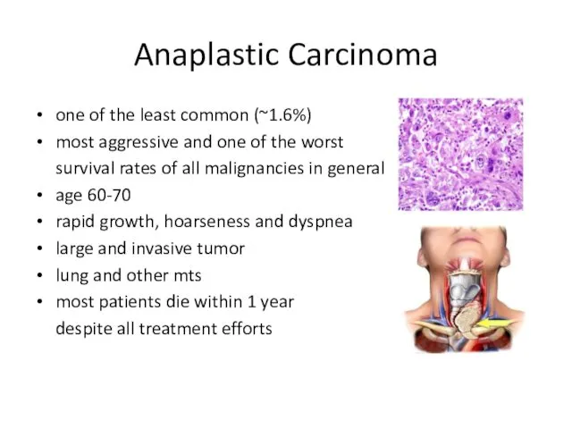Anaplastic Carcinoma one of the least common (~1.6%) most aggressive and