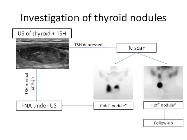 Investigation of thyroid nodules US of thyroid + TSH TSH depressed