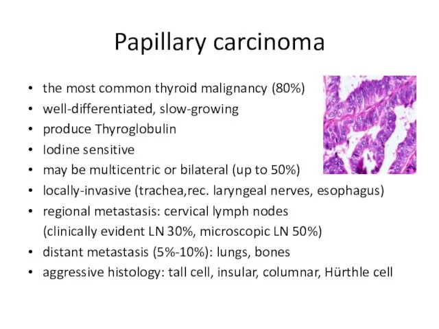 Papillary carcinoma the most common thyroid malignancy (80%) well-differentiated, slow-growing produce