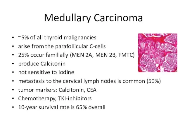 Medullary Carcinoma ~5% of all thyroid malignancies arise from the parafollicular