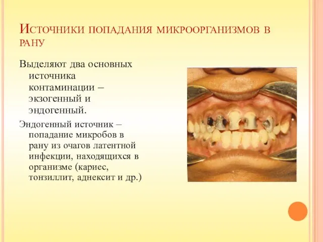 Источники попадания микроорганизмов в рану Выделяют два основных источника контаминации –