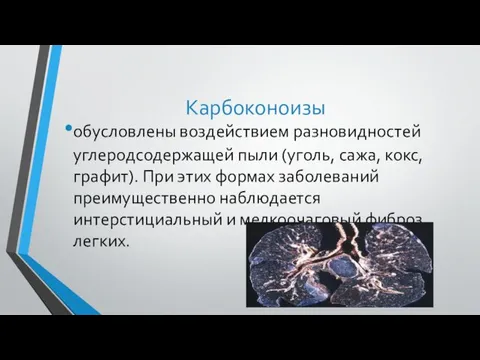 Карбоконоизы обусловлены воздействием разновидностей углеродсодержащей пыли (уголь, сажа, кокс, графит). При