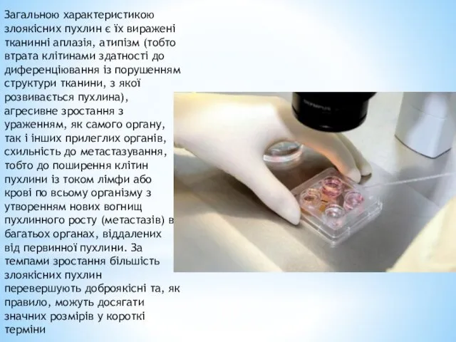 Загальною характеристикою злоякісних пухлин є їх виражені тканинні аплазія, атипізм (тобто