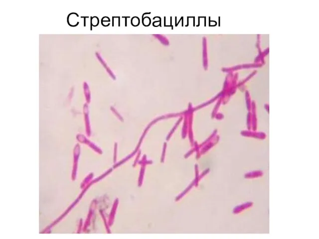 Стрептобациллы