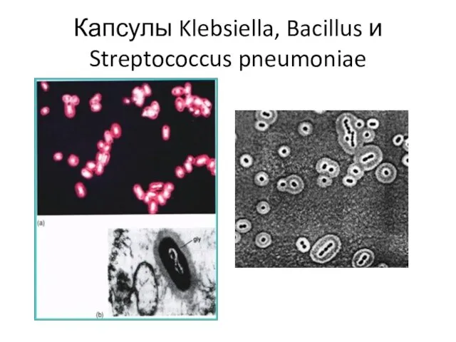 Капсулы Klebsiella, Bacillus и Streptococcus pneumoniae