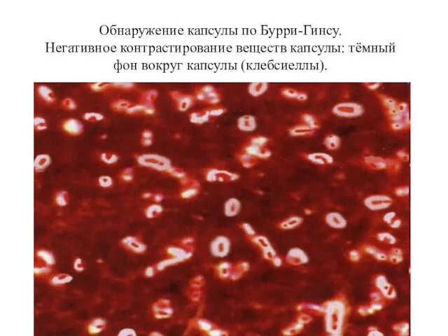 Обнаружение капсулы по Бурри-Гинсу. Негативное контрастирование веществ капсулы: тёмный фон вокруг капсулы (клебсиеллы).