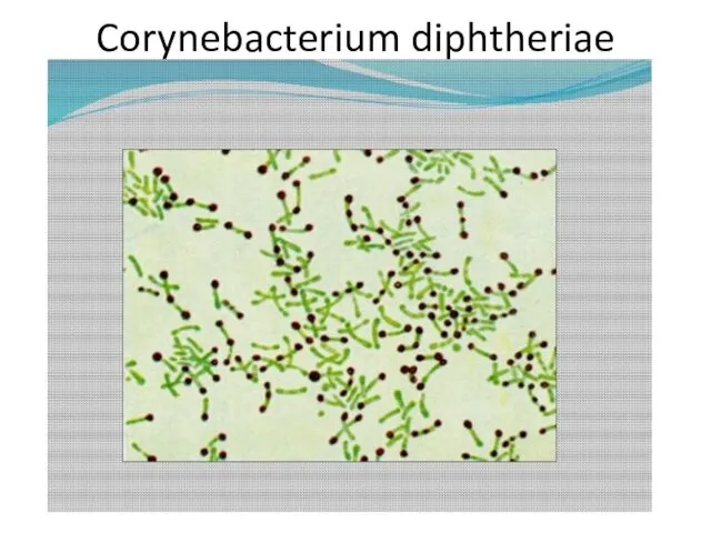 Corynebacterium diphtheriae