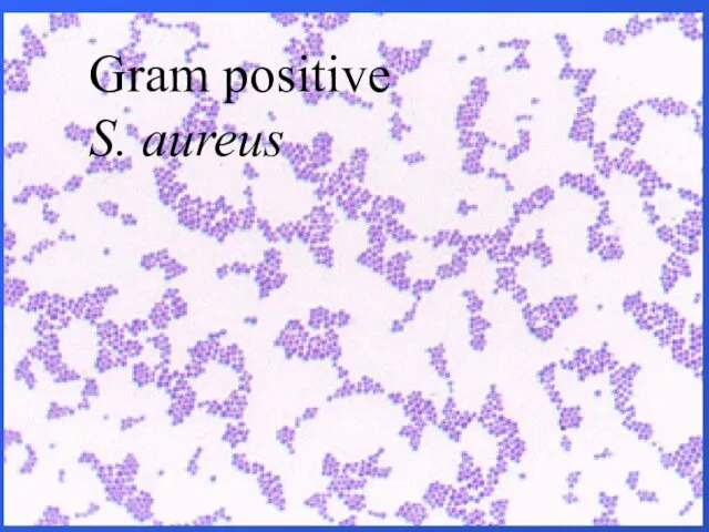 Gram positive S. aureus