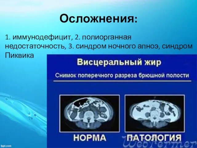 Осложнения: 1. иммунодефицит, 2. полиорганная недостаточность, 3. синдром ночного апноэ, синдром Пиквика