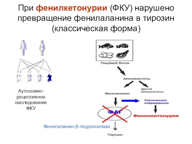 При фенилкетонурии (ФКУ) нарушено превращение фенилаланина в тирозин (классическая форма) Фенилаланин-β-гидроксилаза Аутосомно-рецессивное наследование ФКУ