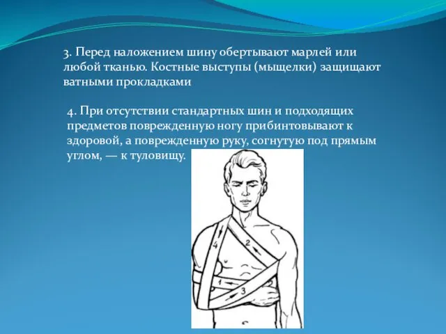 3. Перед наложением шину обертывают марлей или любой тканью. Костные выступы