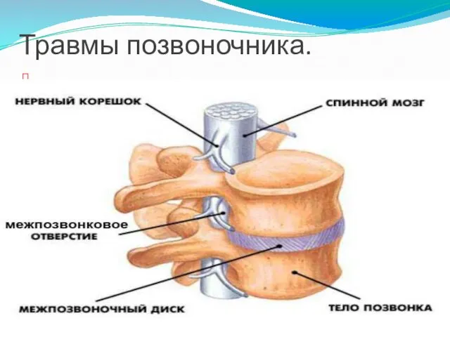 Травмы позвоночника.