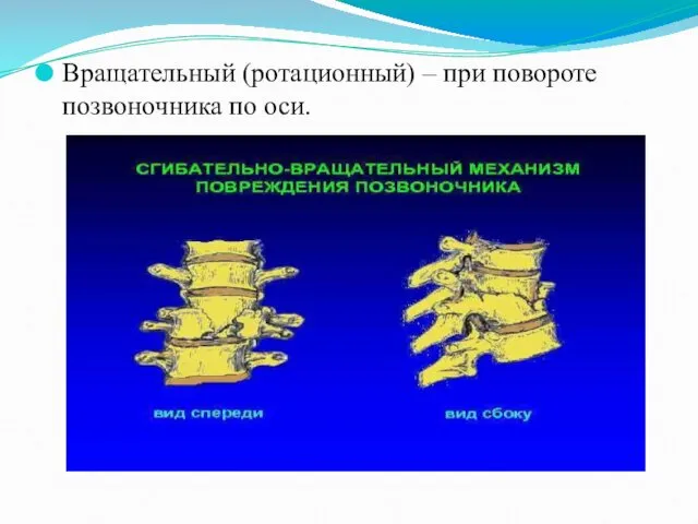 Вращательный (ротационный) – при повороте позвоночника по оси.