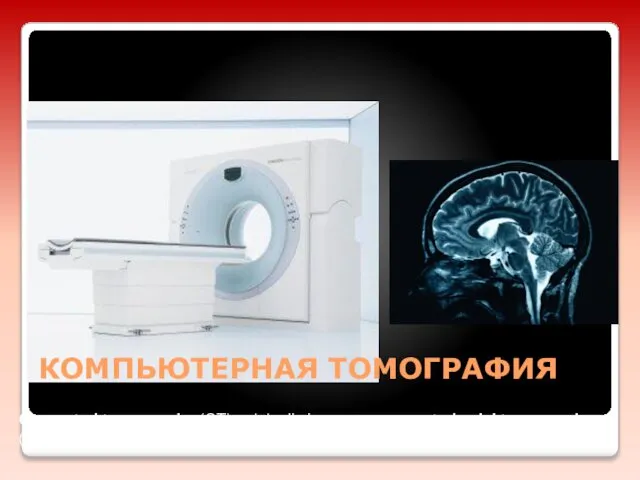 КОМПЬЮТЕРНАЯ ТОМОГРАФИЯ Computed tomography (CT), originally known as computed axial tomography