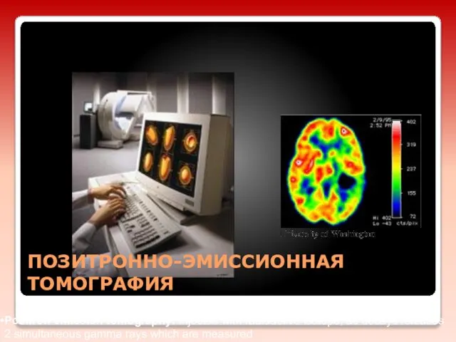 ПОЗИТРОННО-ЭМИССИОННАЯ ТОМОГРАФИЯ Positron emission tomography: injected with radioactive isotope; as decays