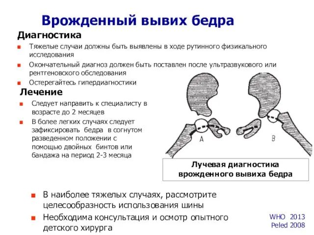 Лечение Следует направить к специалисту в возрасте до 2 месяцев В