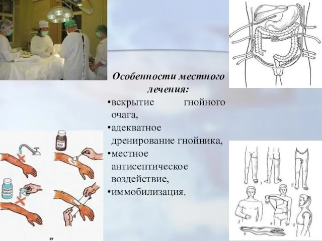 Особенности местного лечения: вскрытие гнойного очага, адекватное дренирование гнойника, местное антисептическое воздействие, иммобилизация.