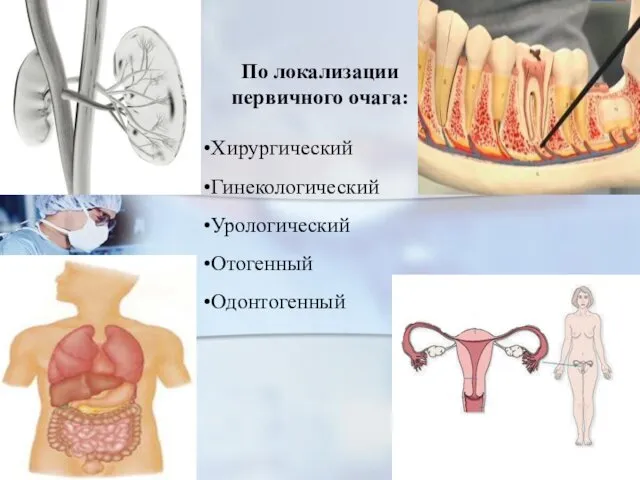 По локализации первичного очага: Хирургический Гинекологический Урологический Отогенный Одонтогенный