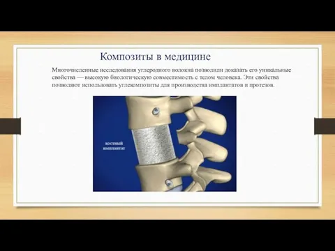 Многочисленные исследования углеродного волокна позволили доказать его уникальные свойства — высокую