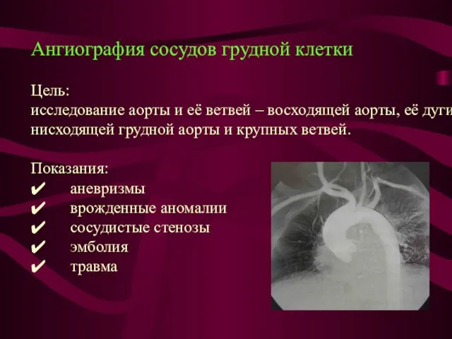 Ангиография сосудов грудной клетки Цель: исследование аорты и её ветвей –