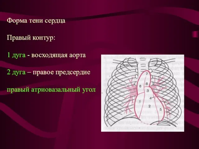 Форма тени сердца Правый контур: 1 дуга - восходящая аорта 2