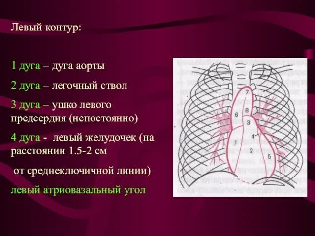 Левый контур: 1 дуга – дуга аорты 2 дуга – легочный