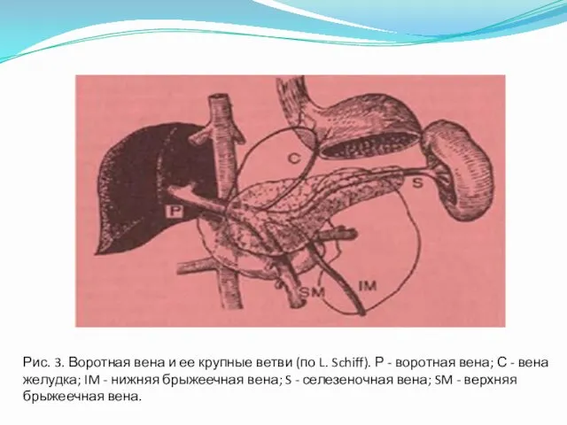 Рис. 3. Воротная вена и ее крупные ветви (по L. Schiff).