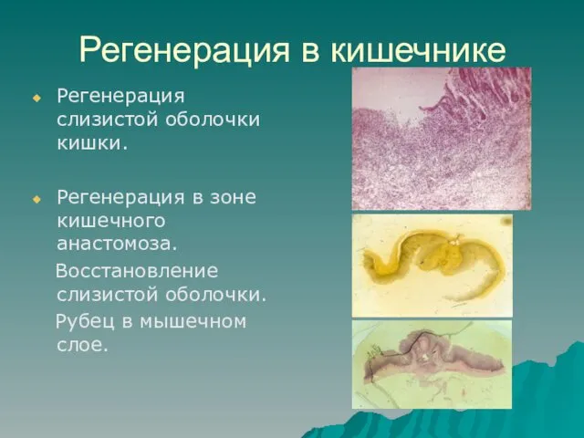 Регенерация в кишечнике Регенерация слизистой оболочки кишки. Регенерация в зоне кишечного