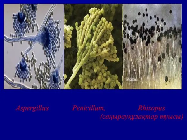 Aspergillus Penicillum, Rhizopus (саңырауқұлақтар туысы)