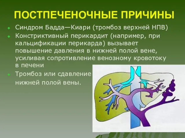 ПОСТПЕЧЕНОЧНЫЕ ПРИЧИНЫ Синдром Бадда—Киари (тромбоз верхней НПВ) Констриктивный перикардит (например, при