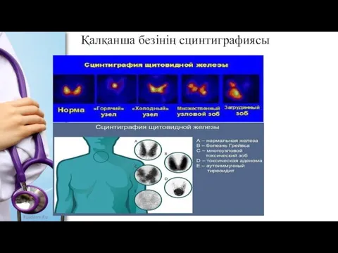 Қалқанша безінің сцинтиграфиясы