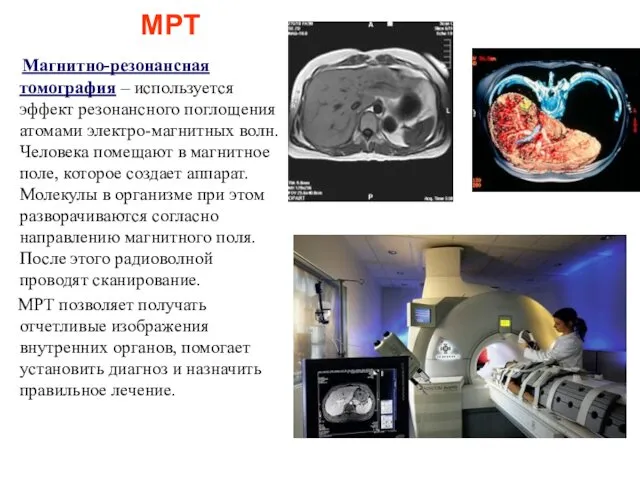 МРТ Магнитно-резонансная томография – используется эффект резонансного поглощения атомами электро-магнитных волн.